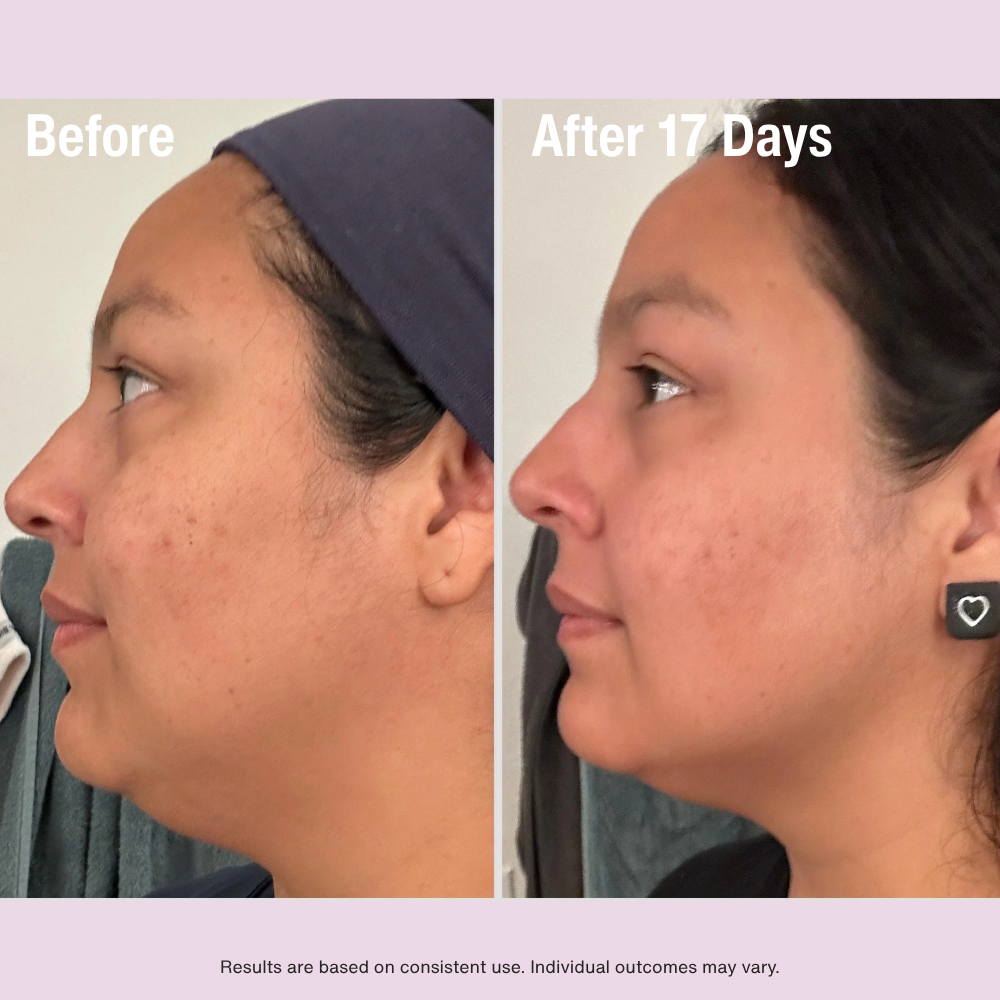 Gloworra Radiance Roller