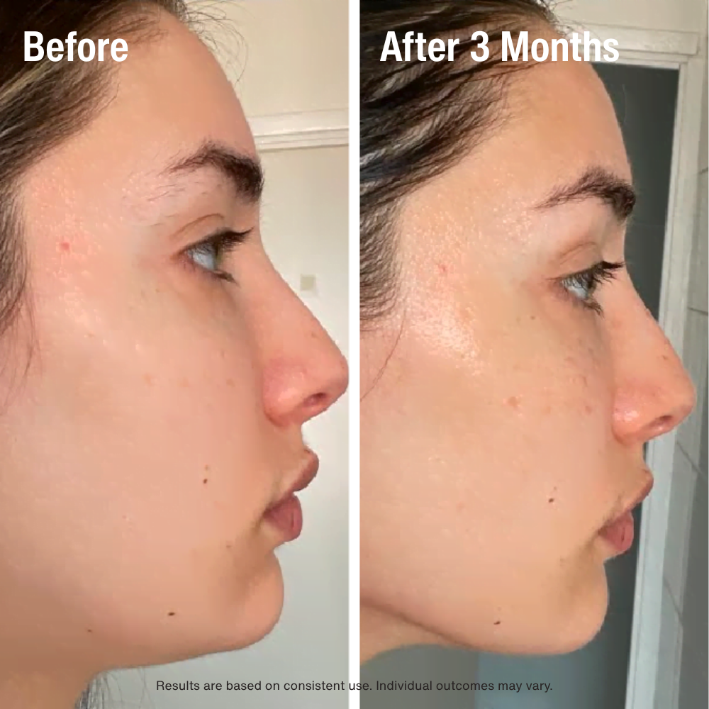 Gloworra Radiance Roller