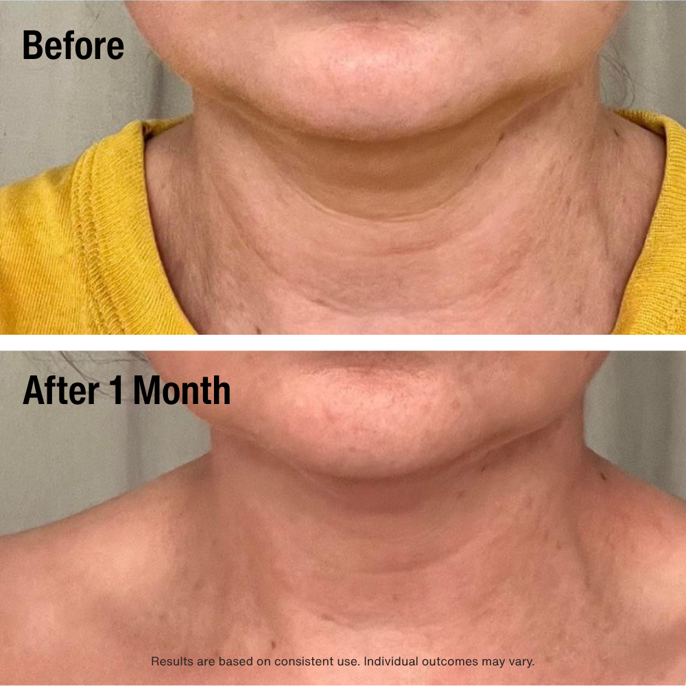 Gloworra Radiance Roller